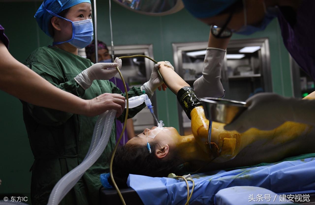 安徽合肥：模特闺蜜同时做隆胸手术，手术仅用了一个小时