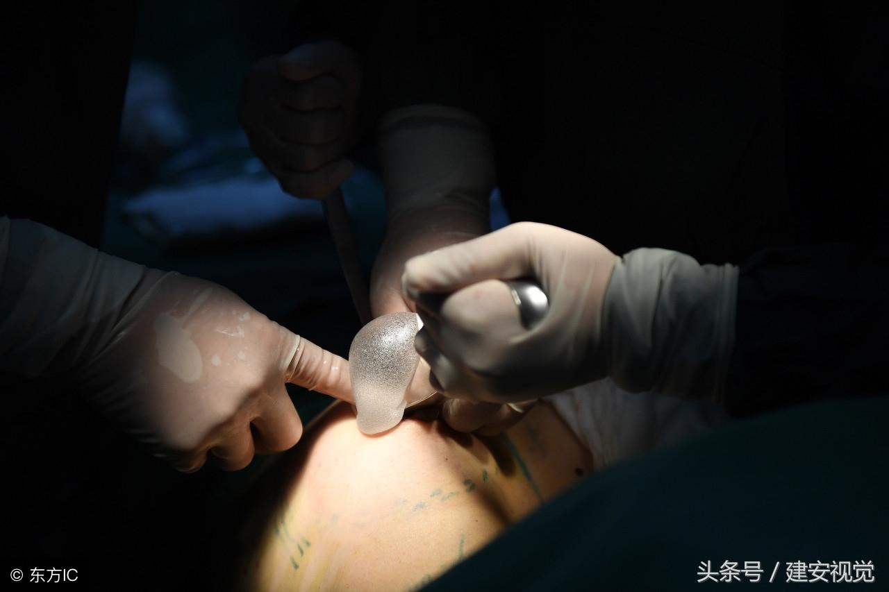 安徽合肥：模特闺蜜同时做隆胸手术，手术仅用了一个小时
