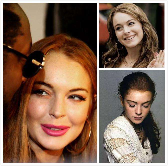 因丰唇而走上毁容之路的法国女神和美国甜姐儿们