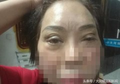 洛阳整形多少钱到毛大夫(洛阳哪个医院有正规整形科)