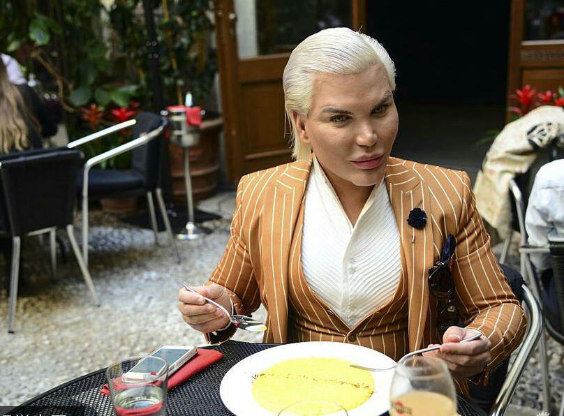 整容狂魔，米兰走秀网友：丑的天崩地裂，连亲妈都不认识