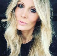 酒窝整形需要多少钱(酒窝整形术后图片)