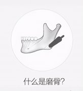 下巴突出整形预算在多少(下巴突出手术一般多少钱)