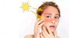 王俊凯代言的防晒霜品牌(王俊凯代言的护肤品牌)