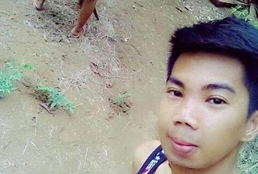 小伙花费70元整容，结果整容失败致脸部溃烂，帅小伙变成丑男