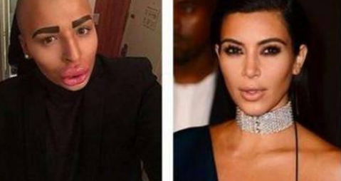 男子为了追星，花费100万整容50次，如今嘴巴变“香肠嘴