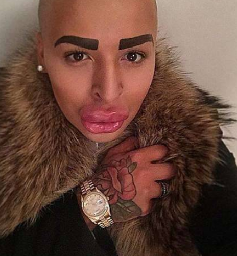 男子为了追星，花费100万整容50次，如今嘴巴变“香肠嘴