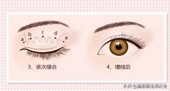 韩国整形准备多少钱(在韩国整容要多少钱)